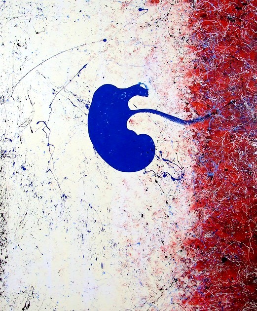 Enorme e gigante quadro cm. 200x170 dal grande valore concettuale, un feto blu dentro il grembo materno con action painting rosso blu e nero